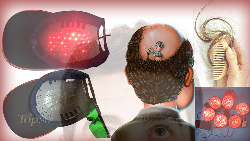 What is Laser Hair Regrowth? Does it Work? Treatment Cost?