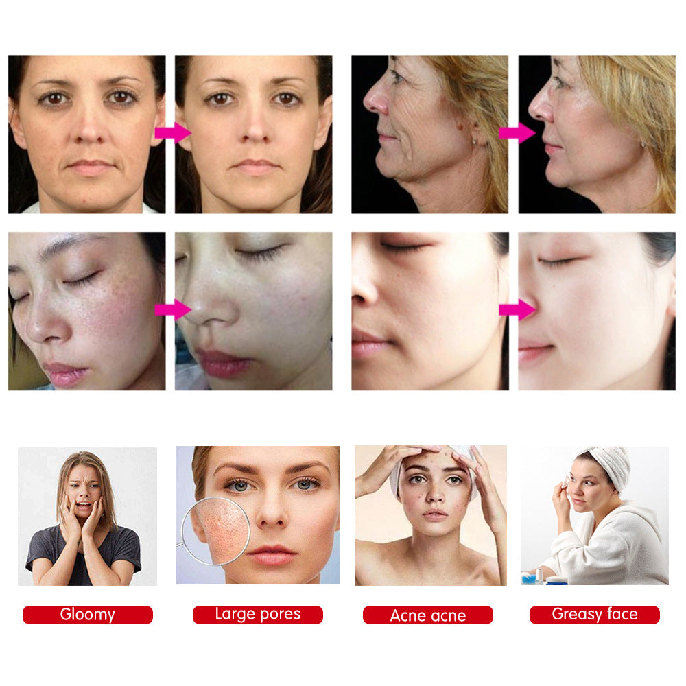 Led Light Therapy Mask For Face And Neck Skin Brightening Acne Treatment